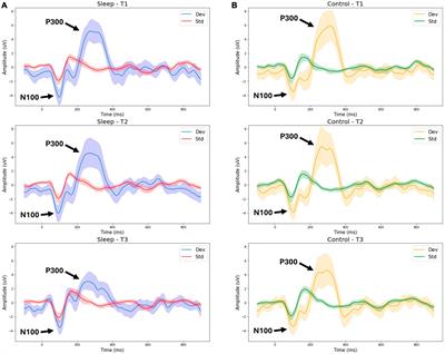 Brain vital sign monitoring of sleep deprivation detects situational cognitive impairment